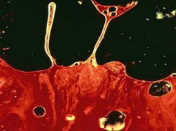 Tinh trùng có máu: Cảnh báo từ tạng thận và lời khuyên của Lão Tuấn