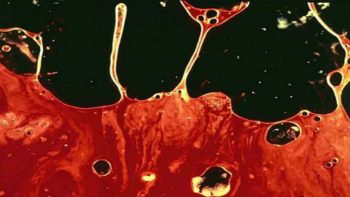 Tinh trùng có máu: Cảnh báo từ tạng thận và lời khuyên của Lão Tuấn