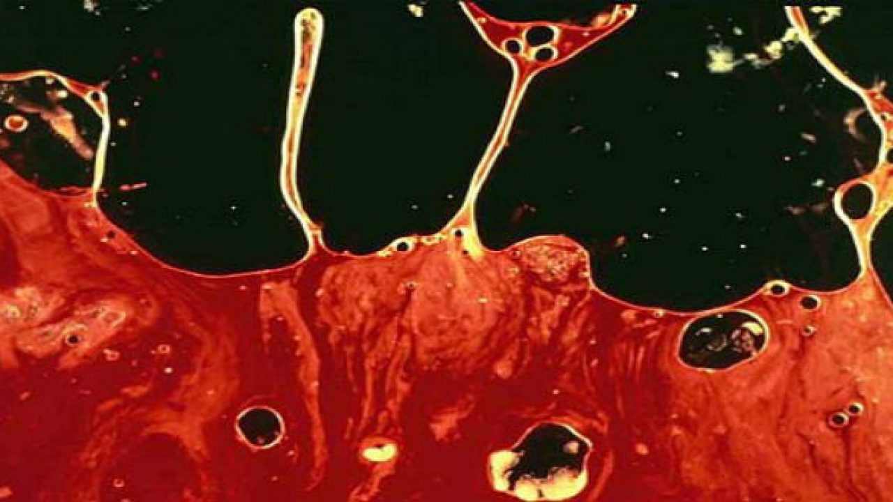 Tinh trùng có máu: Cảnh báo từ tạng thận và lời khuyên của Lão Tuấn