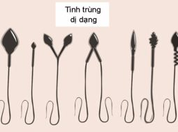 Tinh trùng dị dạng 99 có chữa được không? Lời giải từ Lão Tuấn
