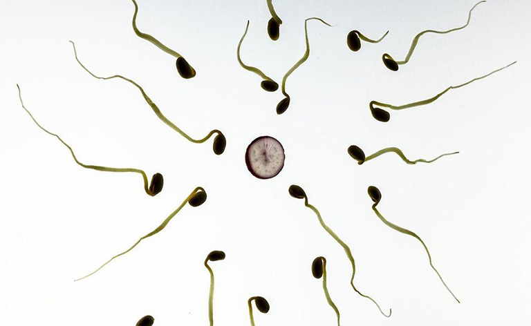 Tinh trùng dị dạng: Thấu hiểu gốc rễ và cách bồi bổ từ tạng Thận