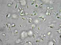 Tinh trùng khuyết tật: Nỗi lo hiếm muộn và cách hóa giải từ gốc Thận