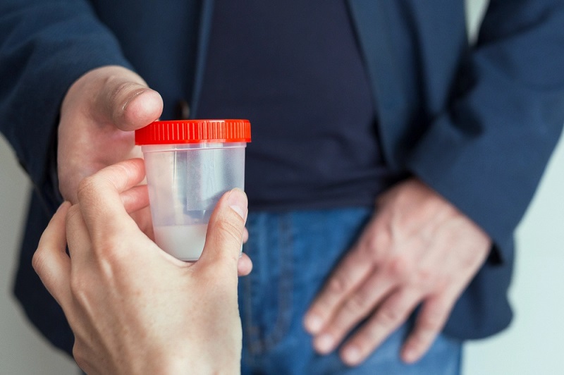 Tinh trùng loãng có phải yếu không? Lời giải chuẩn từ Lão Tuấn