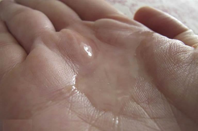 Tinh trùng loãng có con không? Lời khuyên vàng từ Lão Tuấn