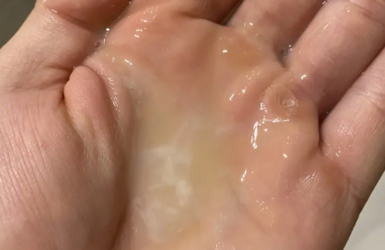 Tinh trùng loãng có con được không? Lời giải từ Lão Tuấn