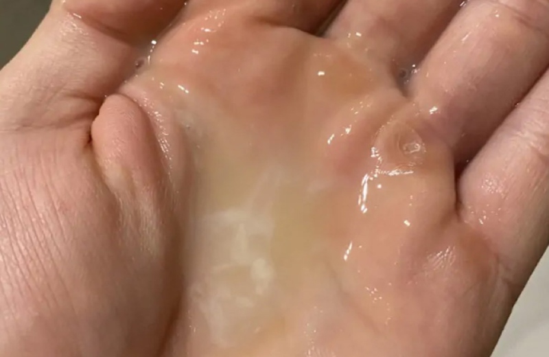 Tinh trùng loãng do đâu? Lời giải từ gốc rễ tạng Thận của Lão Tuấn