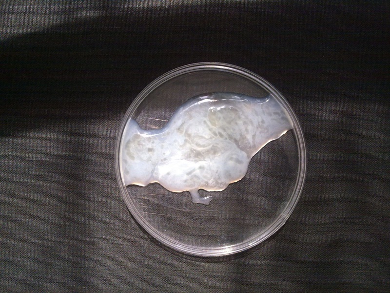 Cách nhận biết tinh trùng yếu và bí quyết bổ thận sinh tinh chuyên sâu