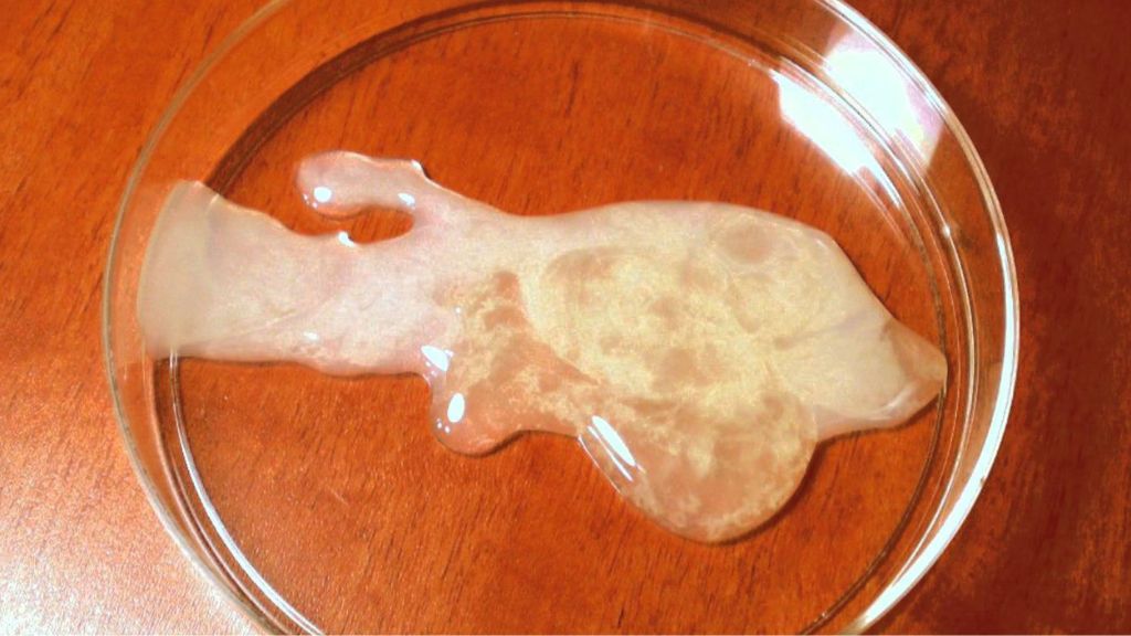 Tinh trùng vón cục màu vàng: Đừng ngó lơ kẻo hối không kịp Anh Em ơi!