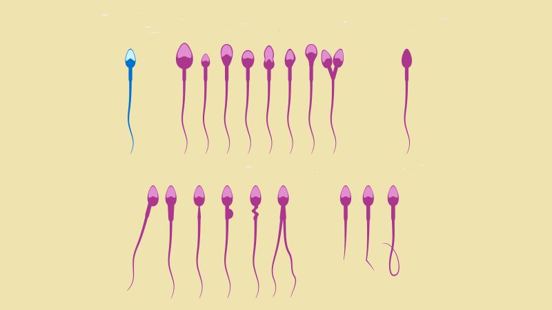 Tinh trùng 2 đầu: Hiểu đúng từ gốc để Anh Em sớm đón tin vui