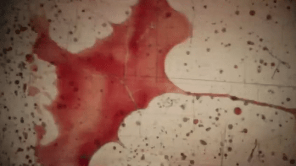 Tinh trùng có màu đỏ: Cảnh báo "huyết tinh" và cách xử lý từ Lão Tuấn