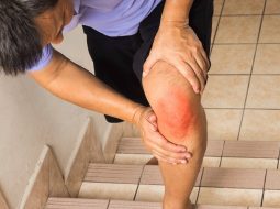 Đừng để sưng đau khớp gối hành hạ – Bí quyết dưỡng gối dẻo dai của Lão