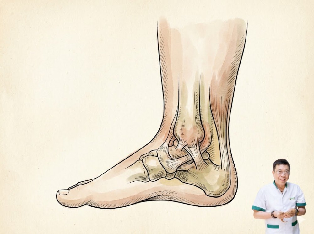 Đau cổ chân ở người béo phì Đau cổ chân ở người béo phì