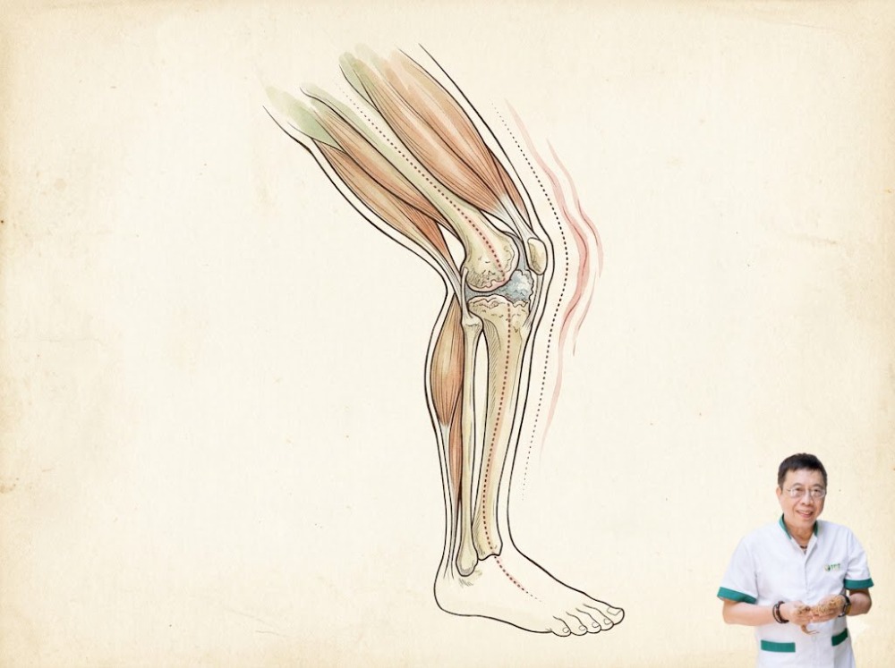 Viêm khớp gối có gây yếu chân không Viêm khớp gối có gây yếu chân không
