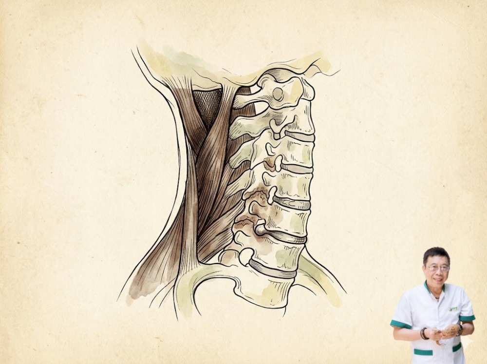 Nguyên nhân đau cột sống cổ