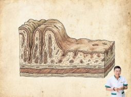 Viêm dạ dày thể teo là gì? Nhận biết và giải pháp điều trị